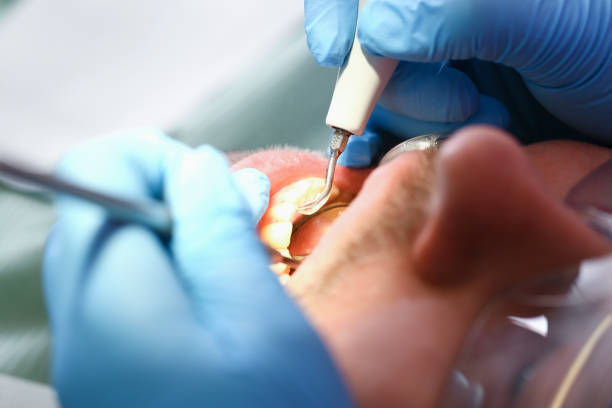 Best Emergency Broken Tooth Repair in Dundee, OR