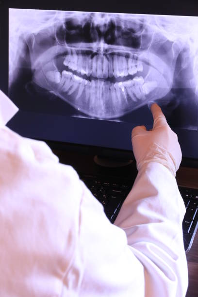 Best Emergency Wisdom Teeth Removal in Dundee, OR
